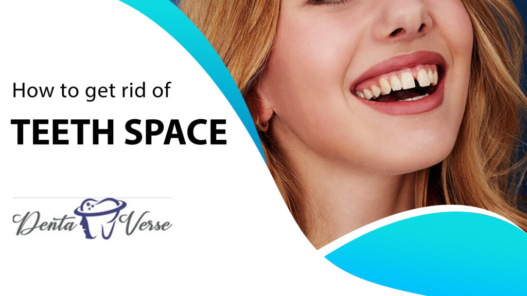 How to get rid of Teeth Space