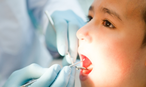 Take care of oral health of your child