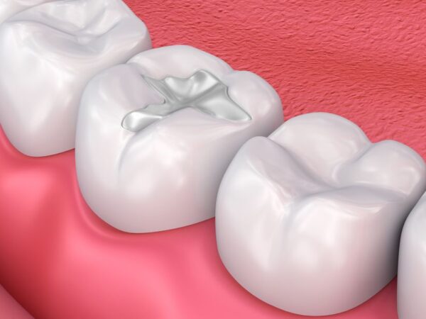 DENTAVERSE DENTAL CLINIC Best Dental Clinic in Hadapsar, Pune, Dentist in Kharadi