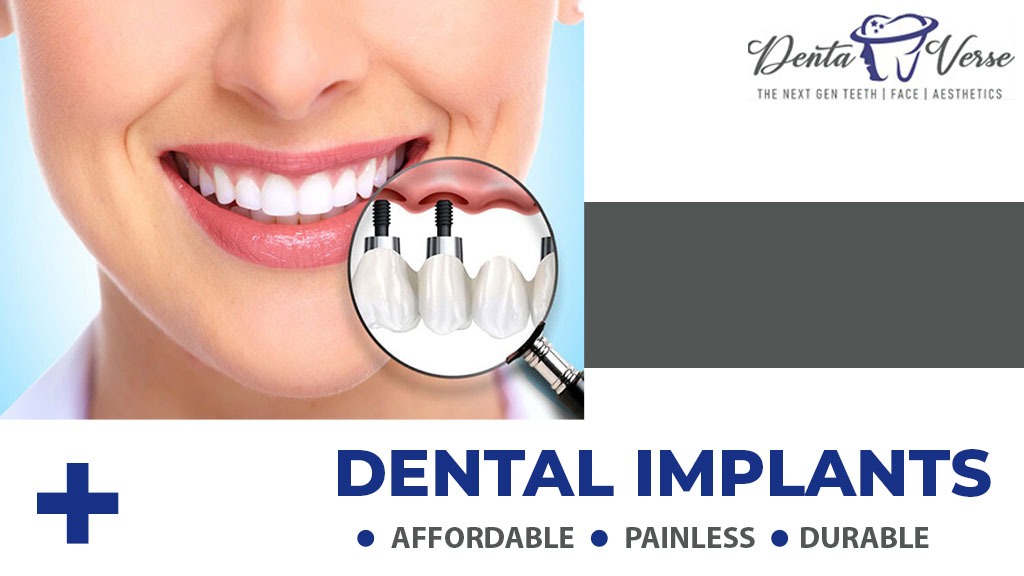 DENTAVERSE DENTAL CLINIC Best Dental Clinic in Hadapsar, Pune, Dentist in Kharadi