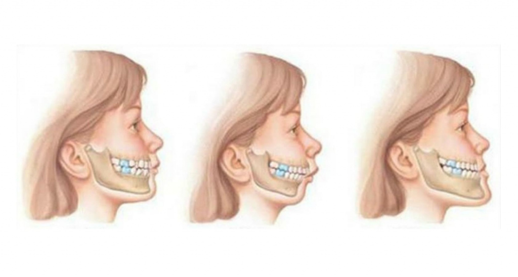 Transform your smile with expert jaw modification at Dentaverse Dental Care