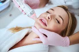 Microneedling treatments at Dentaverse Dental Care