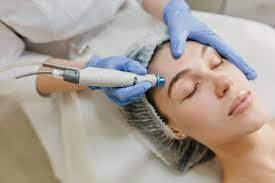 Microneedling for Healthier Skin at Dentaverse Dental Care