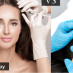 Mesotherapy vs. PRP for Hair Loss Treatment: Which One Is Right for You?