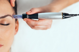 The Complete Guide to Microneedling: Your Pathway to Radiant Skin