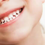 When Do Children Begin to Lose Teeth: A Comprehensive Guide